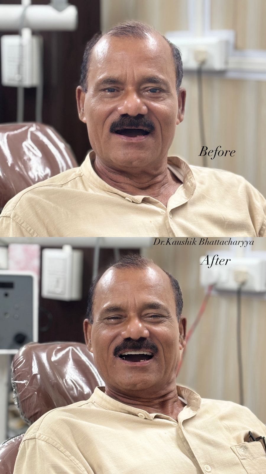 Before and after: Dentures & Prosthetics
