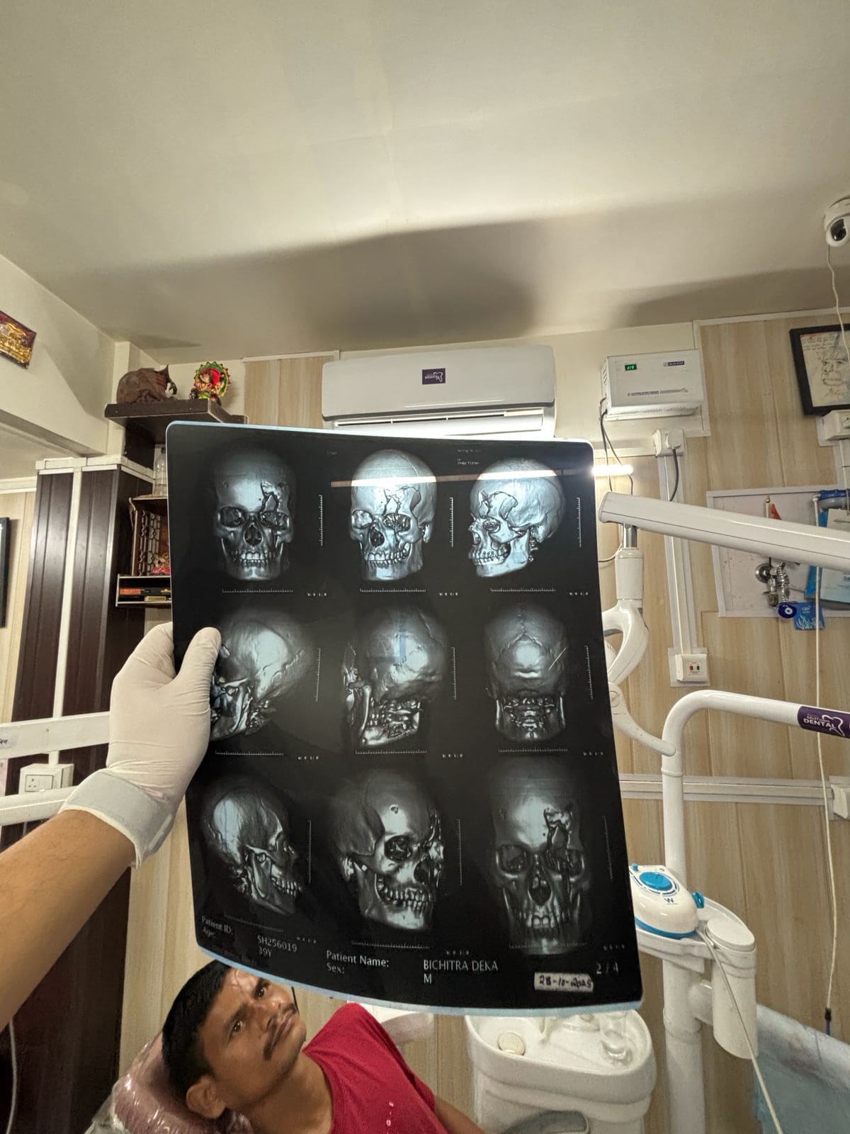 Trauma Cases